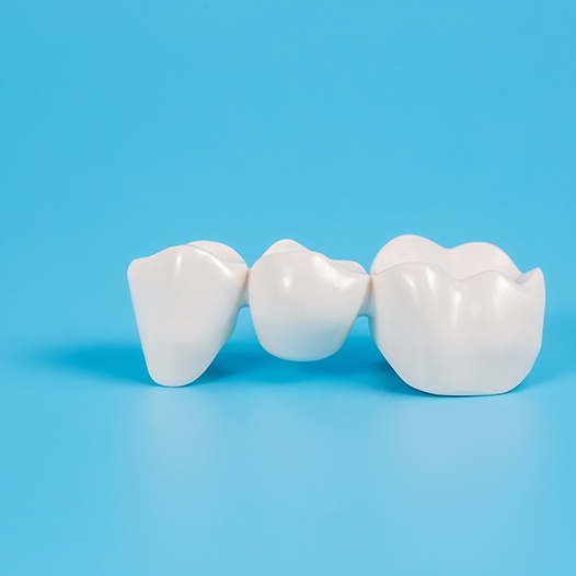 Dental bridge on a blue background